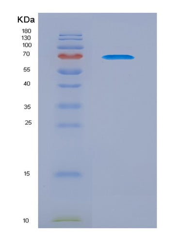 SDS-PAGE analysis of Human CADM1 (Cell Adhesion Molecule 1) - Recombinant Protein, CAT# BLT-06164P, showing >90% purity under 15% SDS-PAGE (Reduced)Human CADM1 (Cell Adhesion Molecule 1) - Recombinant Protein