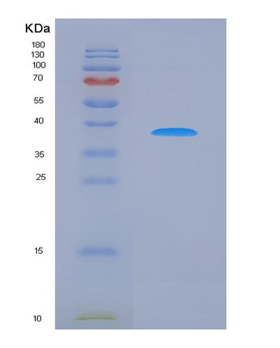 SDS-PAGE analysis of Human BST1 (Adp-Ribosyl Cyclase/Cyclic Adp-Ribose Hydrolase 2) - Recombinant Protein, CAT# BLT-06300P, showing >85% purity under 15% SDS-PAGE (Reduced)Human BST1 (Adp-Ribosyl Cyclase/Cyclic Adp-Ribose Hydrolase 2) - Recombinant Protein