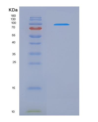 SDS-PAGE analysis of Mouse Nrp1 (Neuropilin-1) - Recombinant Protein, CAT# BLT-07969P, showing >90% purity under 15% SDS-PAGE (Reduced)Mouse Nrp1 (Neuropilin-1) - Recombinant Protein