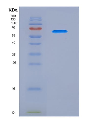 SDS-PAGE analysis of Human PSG1 (Pregnancy-Specific Beta-1-Glycoprotein 1) - Recombinant Protein, CAT# BLT-04704P, showing >95% purity under 15% SDS-PAGE (Reduced)Human PSG1 (Pregnancy-Specific Beta-1-Glycoprotein 1) - Recombinant Protein