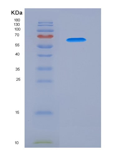 SDS-PAGE analysis of Human PSG1 (Pregnancy-Specific Beta-1-Glycoprotein 1) - Recombinant Protein, CATHuman PSG1 (Pregnancy-Specific Beta-1-Glycoprotein 1) - Recombinant Protein
