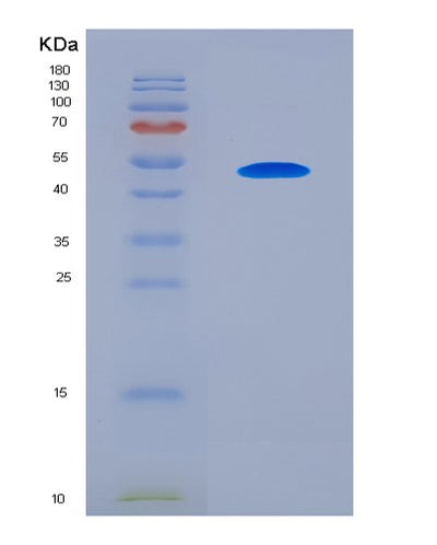 SDS-PAGE analysis of Human SERPINA12 (Serpin A12) - Recombinant Protein, CAT# BLT-05704P, showing >85% purity under 15% SDS-PAGE (Reduced)Human SERPINA12 (Serpin A12) - Recombinant Protein