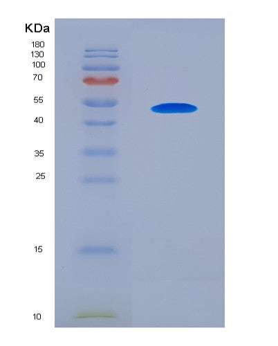 SDS-PAGE analysis of Human SERPINA12 (Serpin A12) - Recombinant Protein, CATHuman SERPINA12 (Serpin A12) - Recombinant Protein
