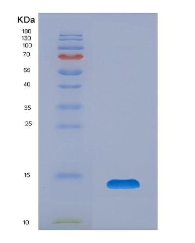 SDS-PAGE analysis of Human TFF1 (Trefoil Factor 1) - Recombinant Protein, CAT# BLT-07973P, showing >90% purity under 15% SDS-PAGE (Reduced)Human TFF1 (Trefoil Factor 1) - Recombinant Protein