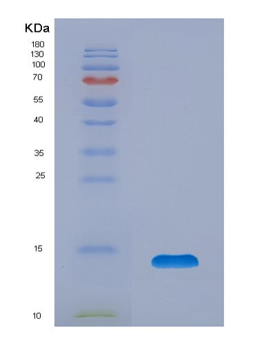 SDS-PAGE analysis of Human TFF1 (Trefoil Factor 1) - Recombinant Protein, CATHuman TFF1 (Trefoil Factor 1) - Recombinant Protein