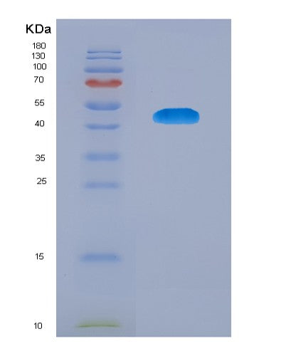 SDS-PAGE analysis of Human TSHR (Thyrotropin Receptor) - Recombinant Protein, CATHuman TSHR (Thyrotropin Receptor) - Recombinant Protein