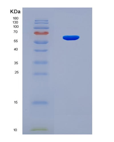 SDS-PAGE analysis of Mouse Thpo (Thrombopoietin) - Recombinant Protein, CAT# BLT-04798P, showing >90% purity under 15% SDS-PAGE (Reduced)Mouse Thpo (Thrombopoietin) - Recombinant Protein
