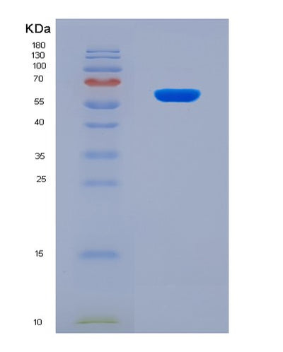 SDS-PAGE analysis of Human CSF2RA (Granulocyte-Macrophage Colony-Stimulating Factor Receptor Subunit Alpha) - Recombinant Protein, CAT# BLT-03723P, showing >95% purity under 15% SDS-PAGE (Reduced)Human CSF2RA (Granulocyte-Macrophage Colony-Stimulating Factor Receptor Subunit Alpha) - Recombinant Protein