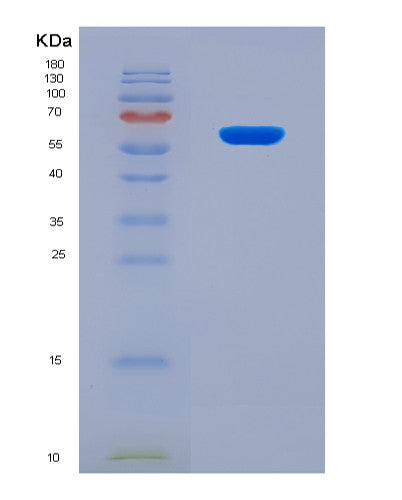 SDS-PAGE analysis of Human CSF2RA (Granulocyte-Macrophage Colony-Stimulating Factor Receptor Subunit Alpha) - Recombinant Protein, CATHuman CSF2RA (Granulocyte-Macrophage Colony-Stimulating Factor Receptor Subunit Alpha) - Recombinant Protein