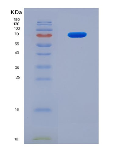 SDS-PAGE analysis of Human BPI (Bactericidal Permeability-Increasing Protein) - Recombinant Protein, CAT# BLT-03941P, showing >90% purity under 15% SDS-PAGE (Reduced)Human BPI (Bactericidal Permeability-Increasing Protein) - Recombinant Protein