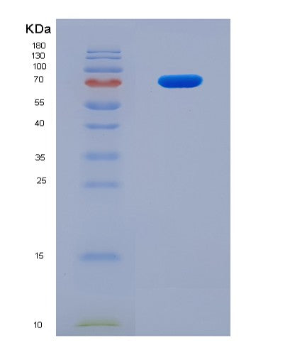 SDS-PAGE analysis of Human BPI (Bactericidal Permeability-Increasing Protein) - Recombinant Protein, CATHuman BPI (Bactericidal Permeability-Increasing Protein) - Recombinant Protein