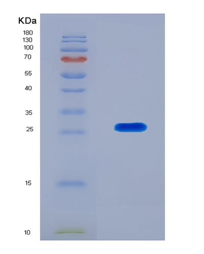 SDS-PAGE analysis of Human BTN3A2 (Butyrophilin Subfamily 3 Member A2) - Recombinant Protein, CAT# BLT-04850P, showing >85% purity under 15% SDS-PAGE (Reduced)Human BTN3A2 (Butyrophilin Subfamily 3 Member A2) - Recombinant Protein