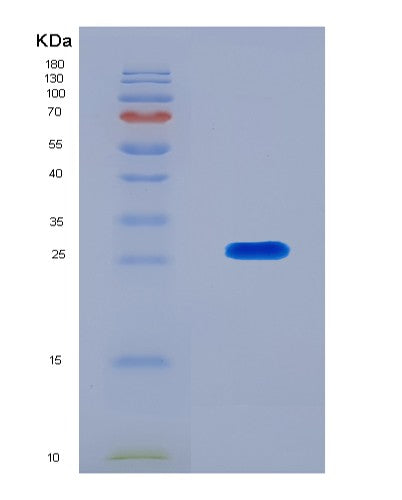 SDS-PAGE analysis of Human BTN3A2 (Butyrophilin Subfamily 3 Member A2) - Recombinant Protein, CATHuman BTN3A2 (Butyrophilin Subfamily 3 Member A2) - Recombinant Protein