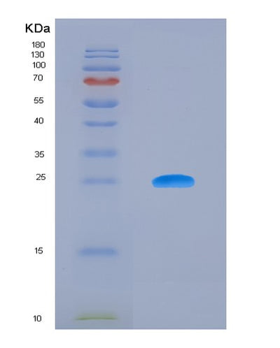SDS-PAGE analysis of Human BTN3A3 (Butyrophilin Subfamily 3 Member A3) - Recombinant Protein, CAT# BLT-03855P, showing >95% purity under 15% SDS-PAGE (Reduced)Human BTN3A3 (Butyrophilin Subfamily 3 Member A3) - Recombinant Protein