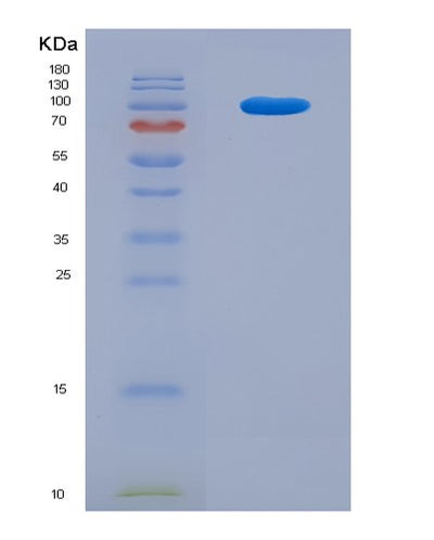 SDS-PAGE analysis of Human C2 (Complement C2) - Recombinant Protein, CAT# BLT-06083P, showing >90% purity under 15% SDS-PAGE (Reduced)Human C2 (Complement C2) - Recombinant Protein