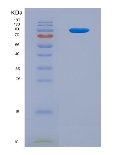 SDS-PAGE analysis of Human C2 (Complement C2) - Recombinant Protein, CATHuman C2 (Complement C2) - Recombinant Protein