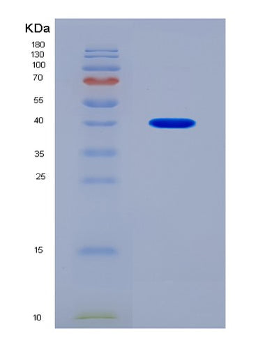 SDS-PAGE analysis of Human GLP1R (Glucagon-Like Peptide 1 Receptor) - Recombinant Protein, CAT# BLT-07976P, showing >90% purity under 15% SDS-PAGE (Reduced)Human GLP1R (Glucagon-Like Peptide 1 Receptor) - Recombinant Protein