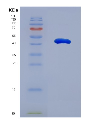 SDS-PAGE analysis of Mouse Muc1 (Mucin-1) - Recombinant Protein, CATMouse Muc1 (Mucin-1) - Recombinant Protein