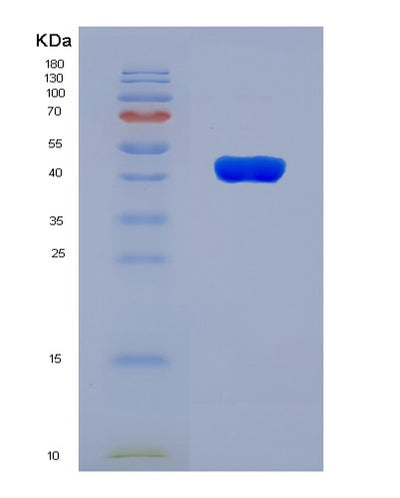 SDS-PAGE analysis of Human TGIF1 (Homeobox Protein Tgif1) - Recombinant Protein, CAT# BLT-07978P, showing >90% purity under 15% SDS-PAGE (Reduced)Human TGIF1 (Homeobox Protein Tgif1) - Recombinant Protein