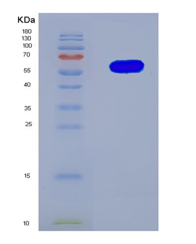 SDS-PAGE analysis of Human PRSS56 (Serine Protease 56) - Recombinant Protein, CAT# BLT-07979P, showing >90% purity under 15% SDS-PAGE (Reduced)Human PRSS56 (Serine Protease 56) - Recombinant Protein