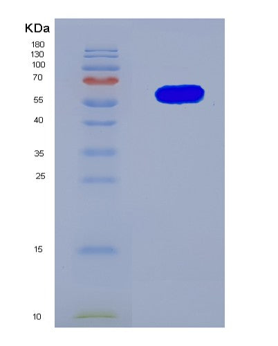 SDS-PAGE analysis of Human PRSS56 (Serine Protease 56) - Recombinant Protein, CATHuman PRSS56 (Serine Protease 56) - Recombinant Protein