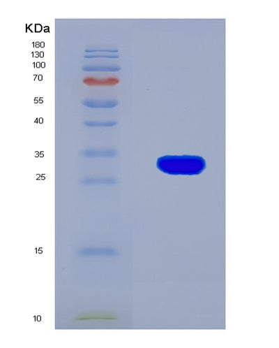 SDS-PAGE analysis of Mouse Serpina7 (Thyroxine-Binding Globulin) - Recombinant Protein, CAT# BLT-07980P, showing >90% purity under 15% SDS-PAGE (Reduced)Mouse Serpina7 (Thyroxine-Binding Globulin) - Recombinant Protein