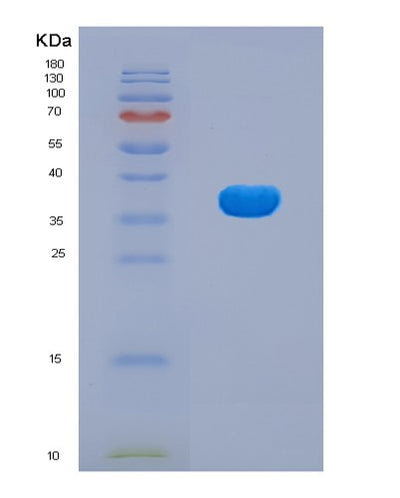 SDS-PAGE analysis of Human EGLN1 (Egl Nine Homolog 1) - Recombinant Protein, CAT# BLT-07981P, showing >90% purity under 15% SDS-PAGE (Reduced)Human EGLN1 (Egl Nine Homolog 1) - Recombinant Protein