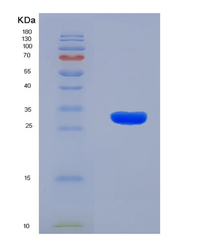 SDS-PAGE analysis of Human PLEC (Plectin) - Recombinant Protein, CAT# BLT-07982P, showing >90% purity under 15% SDS-PAGE (Reduced)Human PLEC (Plectin) - Recombinant Protein
