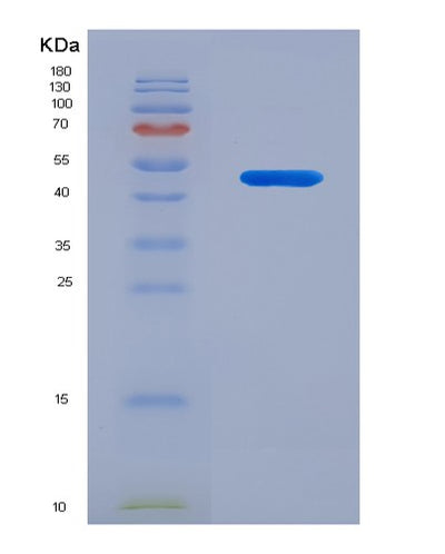 SDS-PAGE analysis of Human LMNA (Prelamin-A/C) - Recombinant Protein, CAT# BLT-07983P, showing >90% purity under 15% SDS-PAGE (Reduced)Human LMNA (Prelamin-A/C) - Recombinant Protein
