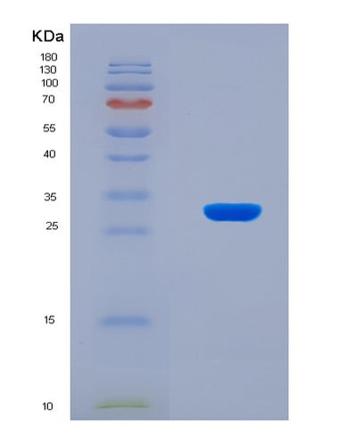 SDS-PAGE analysis of Mouse Stat1 (Signal Transducer And Activator Of Transcription 1) - Recombinant Protein, CAT# BLT-07986P, showing >90% purity under 15% SDS-PAGE (Reduced)Mouse Stat1 (Signal Transducer And Activator Of Transcription 1) - Recombinant Protein
