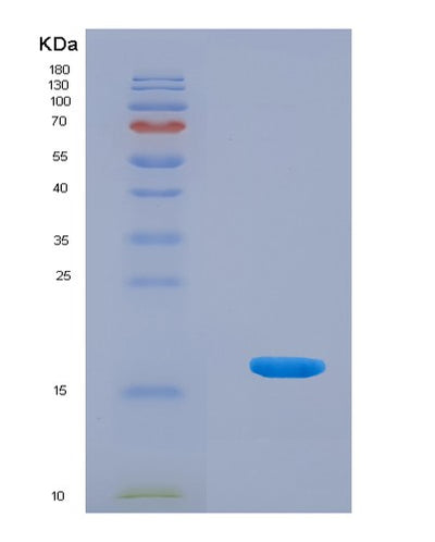 SDS-PAGE analysis of Human NTS (Neurotensin/Neuromedin N) - Recombinant Protein, CAT# BLT-07987P, showing >90% purity under 15% SDS-PAGE (Reduced)Human NTS (Neurotensin/Neuromedin N) - Recombinant Protein