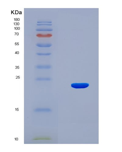 SDS-PAGE analysis of Human HCRT (Hypocretin Neuropeptide Precursor) - Recombinant Protein, CAT# BLT-07988P, showing >90% purity under 15% SDS-PAGE (Reduced)Human HCRT (Hypocretin Neuropeptide Precursor) - Recombinant Protein