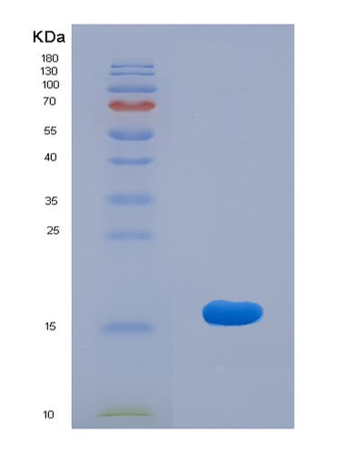 SDS-PAGE analysis of Human GRIA2 (Glutamate Receptor 2) - Recombinant Protein, CAT# BLT-07991P, showing >90% purity under 15% SDS-PAGE (Reduced)Human GRIA2 (Glutamate Receptor 2) - Recombinant Protein