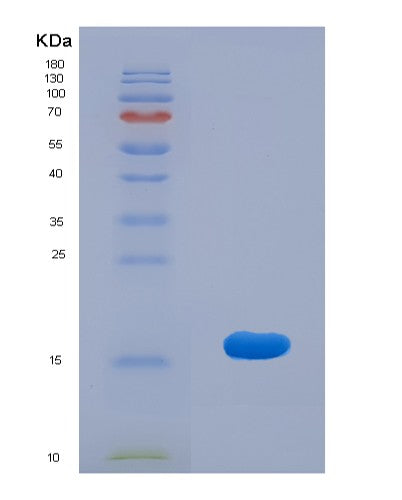 SDS-PAGE analysis of Human GRIA2 (Glutamate Receptor 2) - Recombinant Protein, CATHuman GRIA2 (Glutamate Receptor 2) - Recombinant Protein