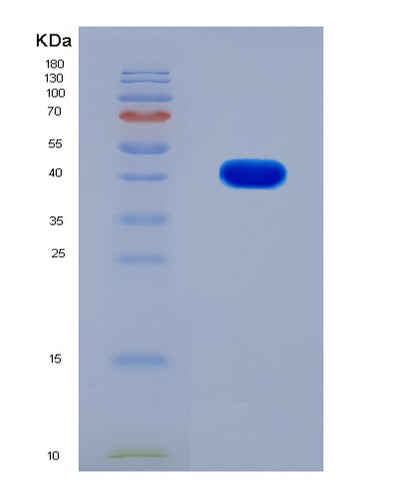 SDS-PAGE analysis of Mouse Anxa2 (Annexin A2) - Recombinant Protein, CAT# BLT-07993P, showing >90% purity under 15% SDS-PAGE (Reduced)Mouse Anxa2 (Annexin A2) - Recombinant Protein
