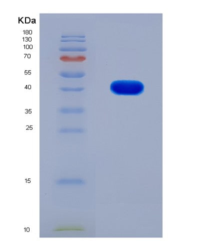 SDS-PAGE analysis of Mouse Anxa2 (Annexin A2) - Recombinant Protein, CATMouse Anxa2 (Annexin A2) - Recombinant Protein