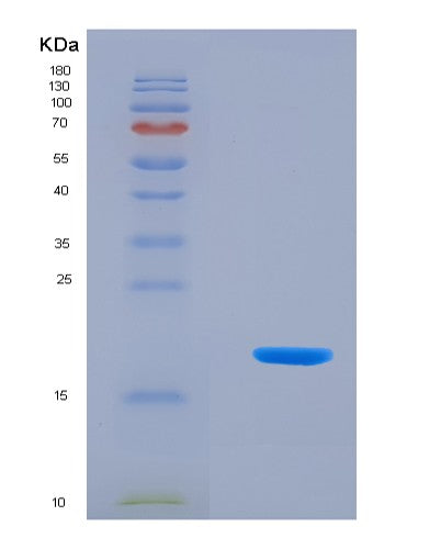 SDS-PAGE analysis of Human KISS1 (Metastasis-Suppressor Kiss-1) - Recombinant Protein, CATHuman KISS1 (Metastasis-Suppressor Kiss-1) - Recombinant Protein
