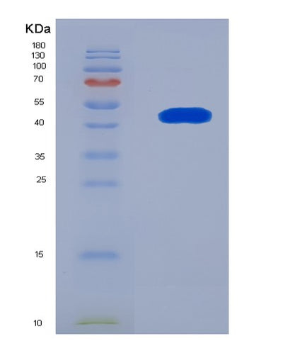 SDS-PAGE analysis of Human TET2 (Methylcytosine Dioxygenase Tet2) - Recombinant Protein, CAT# BLT-07996P, showing >90% purity under 15% SDS-PAGE (Reduced)Human TET2 (Methylcytosine Dioxygenase Tet2) - Recombinant Protein