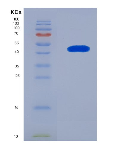 SDS-PAGE analysis of Human TET2 (Methylcytosine Dioxygenase Tet2) - Recombinant Protein, CATHuman TET2 (Methylcytosine Dioxygenase Tet2) - Recombinant Protein