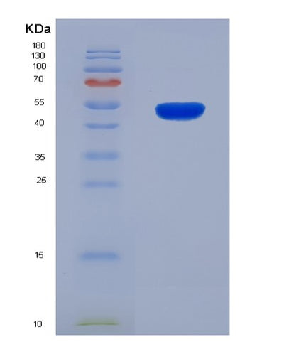 SDS-PAGE analysis of Human MYOG (Myogenin) - Recombinant Protein, CAT# BLT-07997P, showing >90% purity under 15% SDS-PAGE (Reduced)Human MYOG (Myogenin) - Recombinant Protein