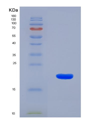 SDS-PAGE analysis of Human TGFB3 (Transforming Growth Factor Beta-3 Proprotein) - Recombinant Protein, CAT# BLT-07998P, showing >90% purity under 15% SDS-PAGE (Reduced)Human TGFB3 (Transforming Growth Factor Beta-3 Proprotein) - Recombinant Protein