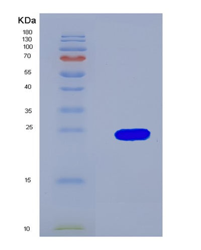 SDS-PAGE analysis of Mouse Igf1r (Insulin-Like Growth Factor 1 Receptor) - Recombinant Protein, CAT# BLT-08000P, showing >90% purity under 15% SDS-PAGE (Reduced)Mouse Igf1r (Insulin-Like Growth Factor 1 Receptor) - Recombinant Protein