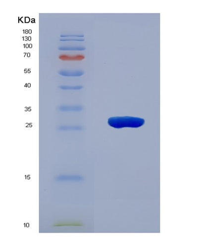 SDS-PAGE analysis of Human C1QTNF3 (Complement C1Q Tumor Necrosis Factor-Related Protein 3) - Recombinant Protein, CAT# BLT-08002P, showing >90% purity under 15% SDS-PAGE (Reduced)Human C1QTNF3 (Complement C1Q Tumor Necrosis Factor-Related Protein 3) - Recombinant Protein