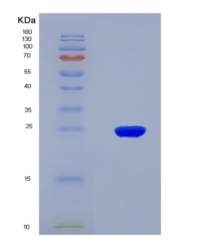 SDS-PAGE analysis of Human CYP26A1 (Cytochrome P450 26A1) - Recombinant Protein, CAT# BLT-08003P, showing >90% purity under 15% SDS-PAGE (Reduced)Human CYP26A1 (Cytochrome P450 26A1) - Recombinant Protein