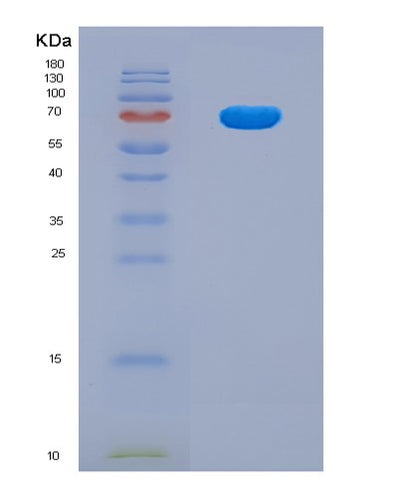SDS-PAGE analysis of Human UMOD (Uromodulin) - Recombinant Protein, CAT# BLT-08004P, showing >90% purity under 15% SDS-PAGE (Reduced)Human UMOD (Uromodulin) - Recombinant Protein