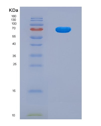 SDS-PAGE analysis of Human UMOD (Uromodulin) - Recombinant Protein, CATHuman UMOD (Uromodulin) - Recombinant Protein