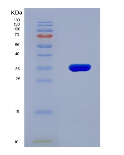 SDS-PAGE analysis of Human CDH17 (Cadherin-17) - Recombinant Protein, CAT# BLT-08005P, showing >90% purity under 15% SDS-PAGE (Reduced)Human CDH17 (Cadherin-17) - Recombinant Protein