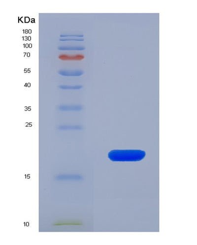 SDS-PAGE analysis of Human HTR1A (5-Hydroxytryptamine Receptor 1A) - Recombinant Protein, CAT# BLT-08006P, showing >90% purity under 15% SDS-PAGE (Reduced)Human HTR1A (5-Hydroxytryptamine Receptor 1A) - Recombinant Protein