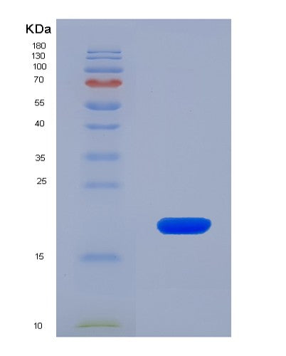SDS-PAGE analysis of Human HTR1A (5-Hydroxytryptamine Receptor 1A) - Recombinant Protein, CATHuman HTR1A (5-Hydroxytryptamine Receptor 1A) - Recombinant Protein