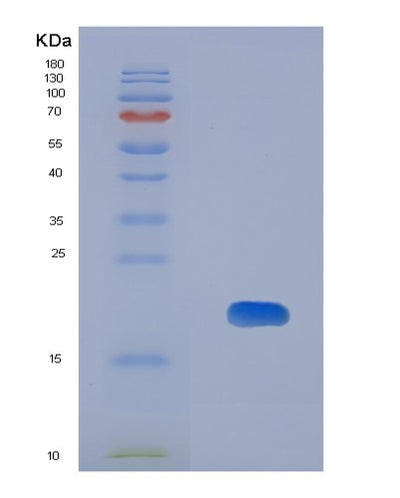SDS-PAGE analysis of Human HTN1 (Histatin-1) - Recombinant Protein, CAT# BLT-08008P, showing >90% purity under 15% SDS-PAGE (Reduced)Human HTN1 (Histatin-1) - Recombinant Protein